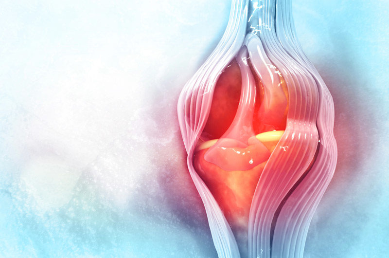 Illustration-of-a-human-knee-requiring-post-surgery-physical-therapy-for-a-meniscus-injury