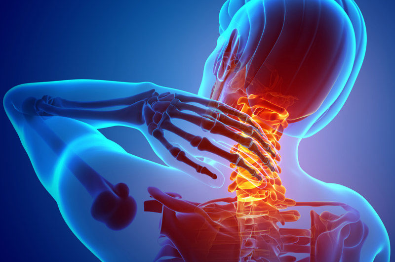 3D-illustration-of-neck-pain