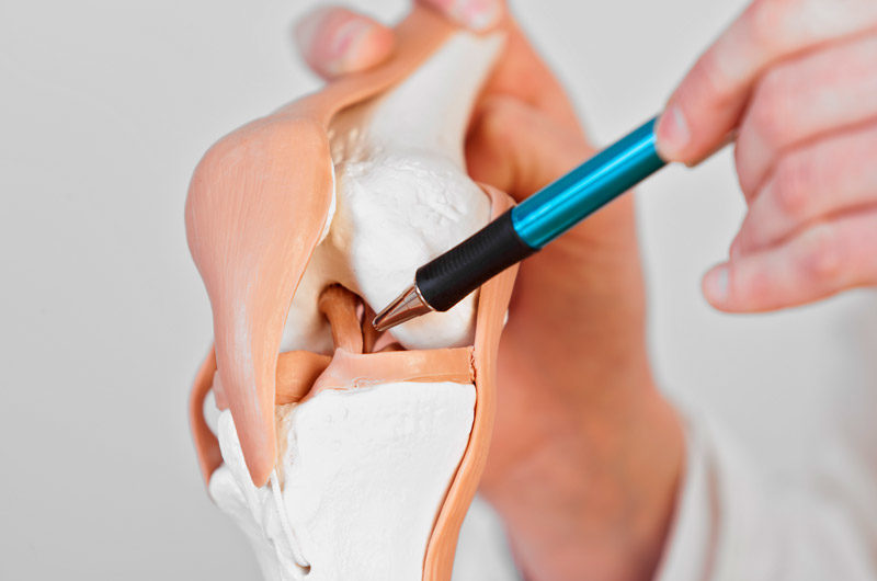 Doctor-holding-model-of-knee-to-demonstrate-cause-of-anterior-knee-pain